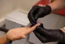 İzmir Büyükşehir’den Kimlik Gerektirmeyen Ücretsiz Test Hizmeti