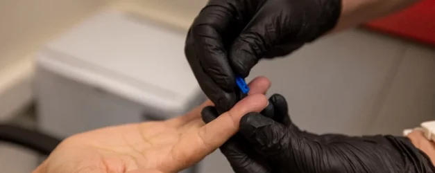 İzmir Büyükşehir’den Kimlik Gerektirmeyen Ücretsiz Test Hizmeti